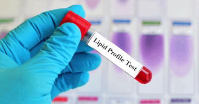 Lipid Profile Test Pune | Lipid Profile Test Near Me