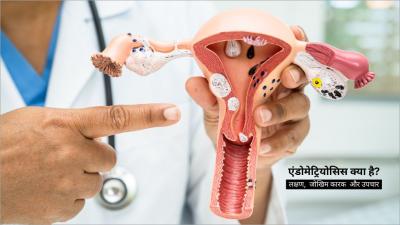 एंडोमेट्रियोसिस क्या है? (Endometriosis Meaning in Hindi)