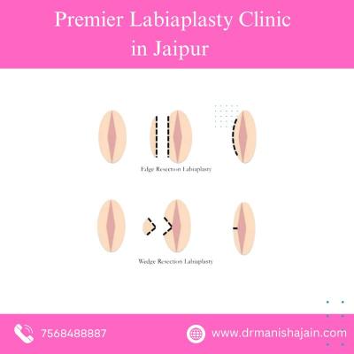 Premier Labiaplasty Clinic in Jaipur  - Jaipur Health, Personal Trainer