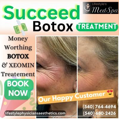 Botox fine lines services in Culpeper VA | Book Now