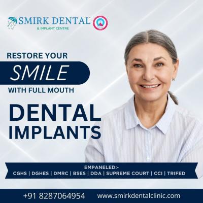 Best Implant Dentist Near Me - Delhi Health, Personal Trainer