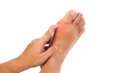 Effective Bunion Pain Relief at Footworks Podiatry - Singapore Region Health, Personal Trainer
