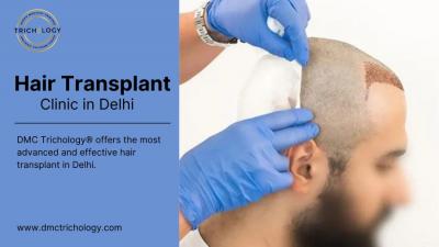 Hair Transplant Clinic in Delhi - Delhi Health, Personal Trainer