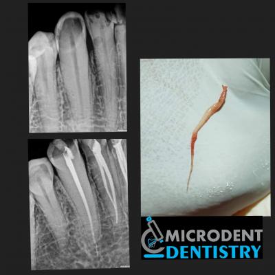 Best Dental Clinic Parvati Near Me  | Microdent Dentistry - Pune Health, Personal Trainer