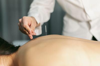 Achieve Holistic Wellbeing with Acupuncture in Centre London