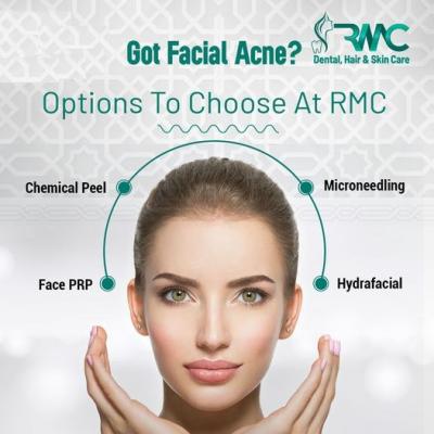 Best Acnes Cars Treatment in Islamabad - Rehman Medical Center - Islamabad Health, Personal Trainer