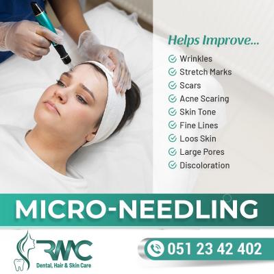 Microneedling in Islamabad | Rehman Medical Center - Islamabad Health, Personal Trainer