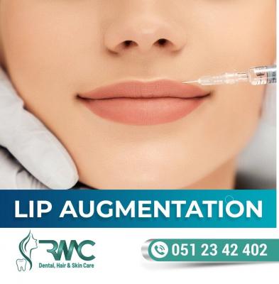 Lip Filler Treatment in Islamabad, Injections -Rehman Medical Center - Islamabad Health, Personal Trainer