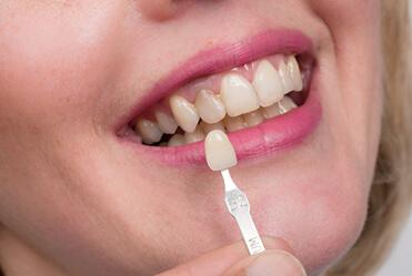 Dental Bridge Specialist: Restore Your Smile with Expert Care!