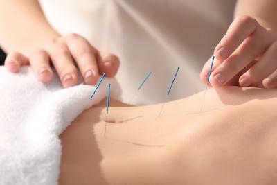 Achieve Optimal Health with Acupuncture in Central London - London Health, Personal Trainer