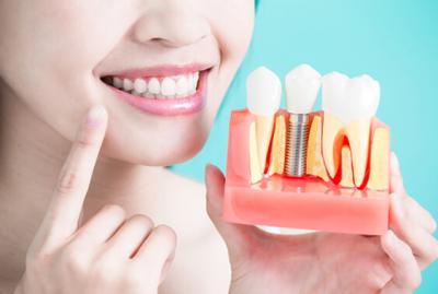 Transform Your Smile with Dr. Bridges, Expert Dentist