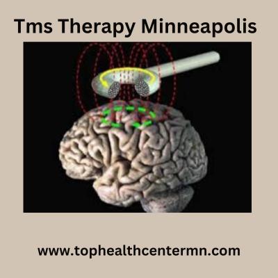 Exploring TMS Therapy in Minneapolis - Minneapolis Health, Personal Trainer