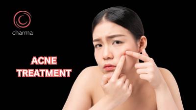 Acne Treatment in Bangalore at Charma Clinic - Bangalore Health, Personal Trainer