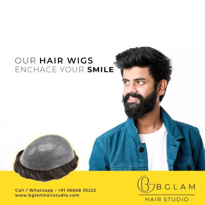 Best hair patch in Hyderabad - Hyderabad Health, Personal Trainer