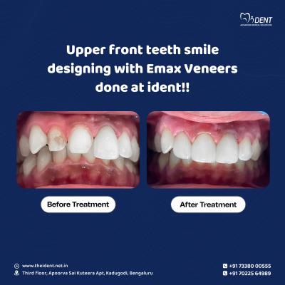 Comprehensive Dental Care Solutions in Kadugodi  Your Smile Matters - Bangalore Health, Personal Trainer