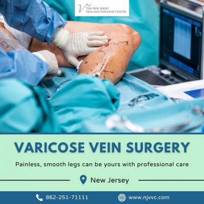 Varicose Vein Surgery in NJ