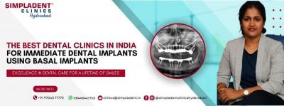 Dr Shiva Nagini - Best Implantologist in Hyderabad - Hyderabad Rentals