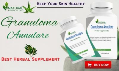 Herbal Supplement for Granuloma Annular - Delhi Health, Personal Trainer