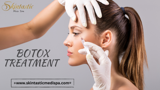 Wrinkle and Fine Lines Free Botox in Riverside - Sacramento Other