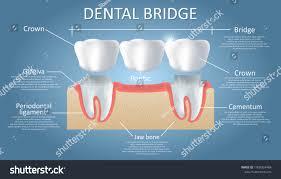 Dental Wellness Plan in Lithia: Affordable Care Options