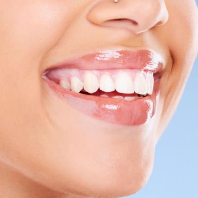 Teeth Whitening and Straightening - Other Health, Personal Trainer