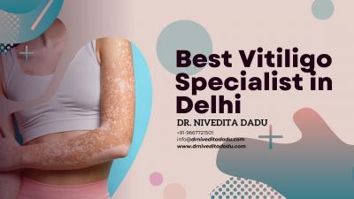 Best Vitiligo Specialist in Delhi at Dadu Medical Centre - Delhi Health, Personal Trainer