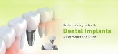 Best Quality Dental Implants in India - Mumbai Health, Personal Trainer