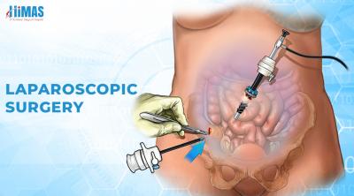 Best Laparoscopic Surgery in Basavanagudi Bangalore -  Himas Hospital