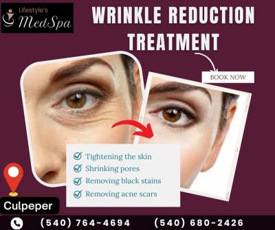 Wrinkle Treatment in Warrenton | Lifestyle’s MedSpa - Virginia Beach Health, Personal Trainer