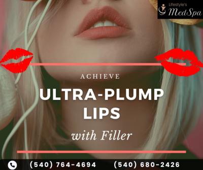 Ultra Plump Lips Treatment in Culpeper | Lifestyle’s MedSpa - Virginia Beach Health, Personal Trainer