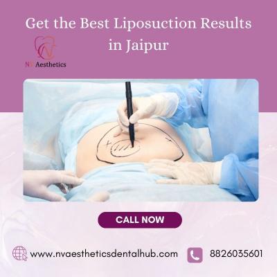 Get the Best Liposuction Results in Jaipur - Jaipur Other