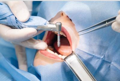 Dental Surgeon Penrith - Sydney Other