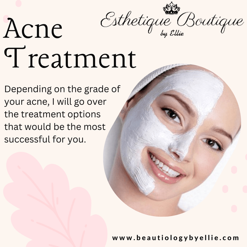 Esthetician for Acne Treatment in Los Angeles