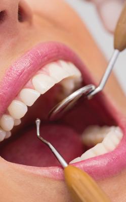 Get the best root canal Treatment | Nuevo Perris Dental