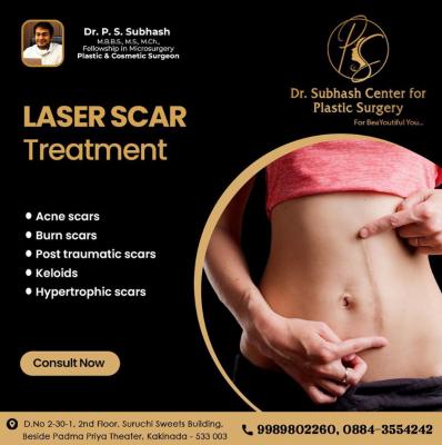 Effective Laser Scar Treatment by Dr. Subhash in Kakinada - Other Health, Personal Trainer