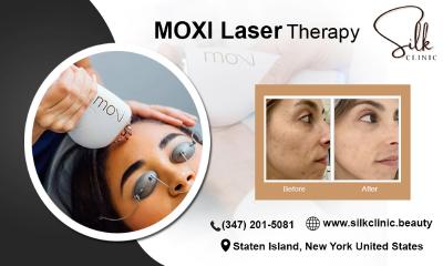 Non-Surgical Skin Tightening with MOXI Laser in New York