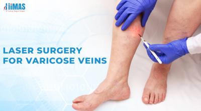 Best Laser Surgery for Varicose Veins at Himas Hospital in Basavanagudi Bangalore