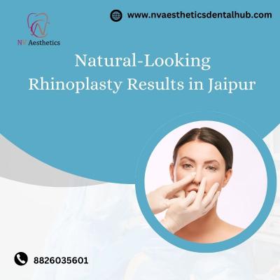 Natural-Looking Rhinoplasty Results in Jaipur - Jaipur Other