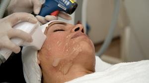 Best Microdermabrasion Treatment - Other Other