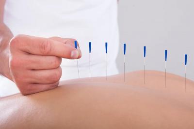 Acupuncture NYC - Other Health, Personal Trainer