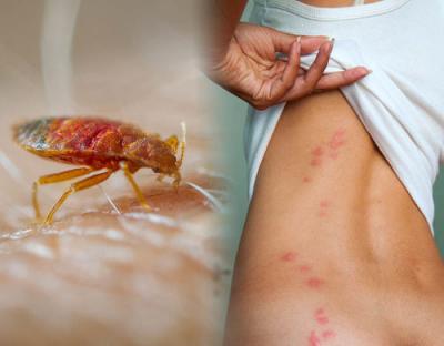 Effective Bed Bug Removal – Call Today!