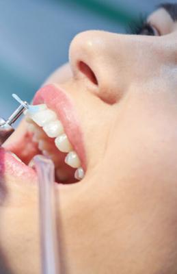 Get the best dental Implants clinic in Perris | Nuevo Perris