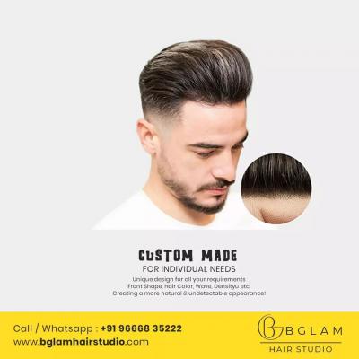 Hair patch center in hyderabad - Hyderabad Other