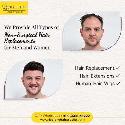 Hair patch center in hyderabad - Hyderabad Other