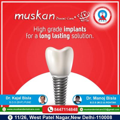 Smile Makeovers in Delhi NCR – Muskan Dental Care | 9818822991 