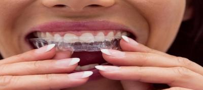 Porcelain veneers in Southampton | Hampshire - London Other