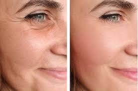 Effective Dark Spot Removal Solutions