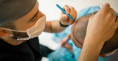 5 Best Hair Transplant Centre in Jaipur