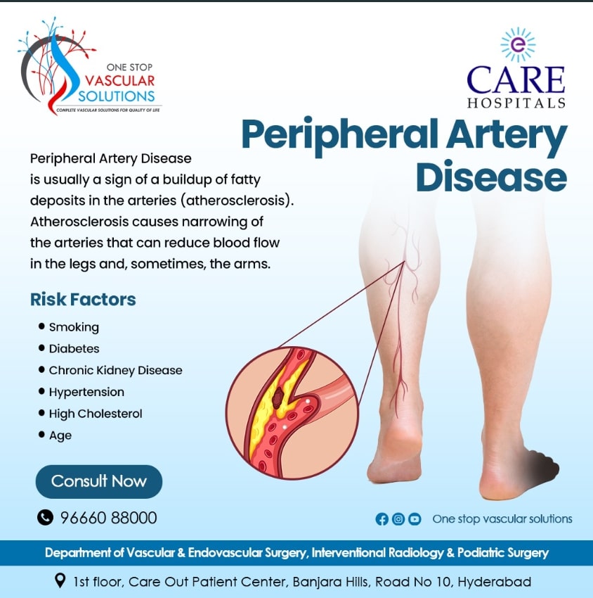 Fight Peripheral Artery Disease with Expert Care at one-stop Vascular Solutions