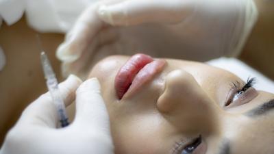 Book Now Dermal filler for Ultra plump lips